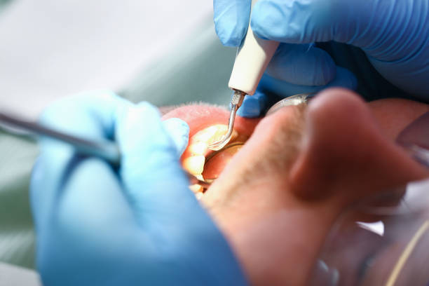 Best After-Hours Emergency Dentist in Shawneetown, IL