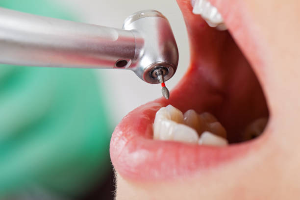 Best Weekend Emergency Dentist in Shawneetown, IL